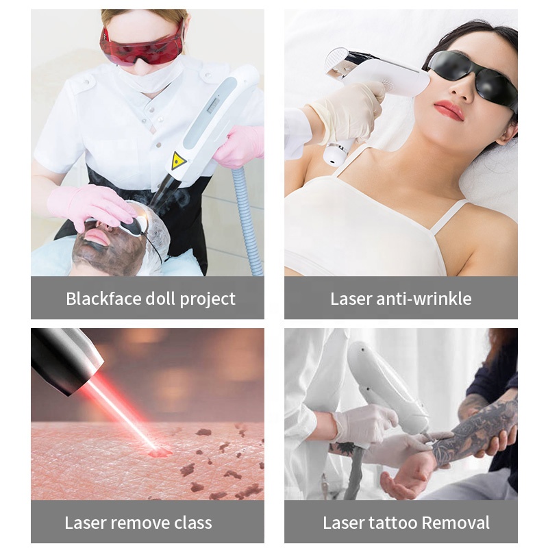 Fabrika Fiyatı 230W Lazer Güze - Industrial Laser Price incelemesi ve fiyatı